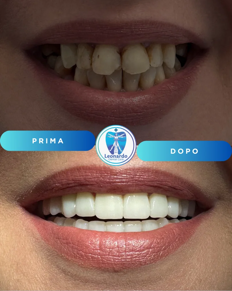 Prima e Dopo 1
