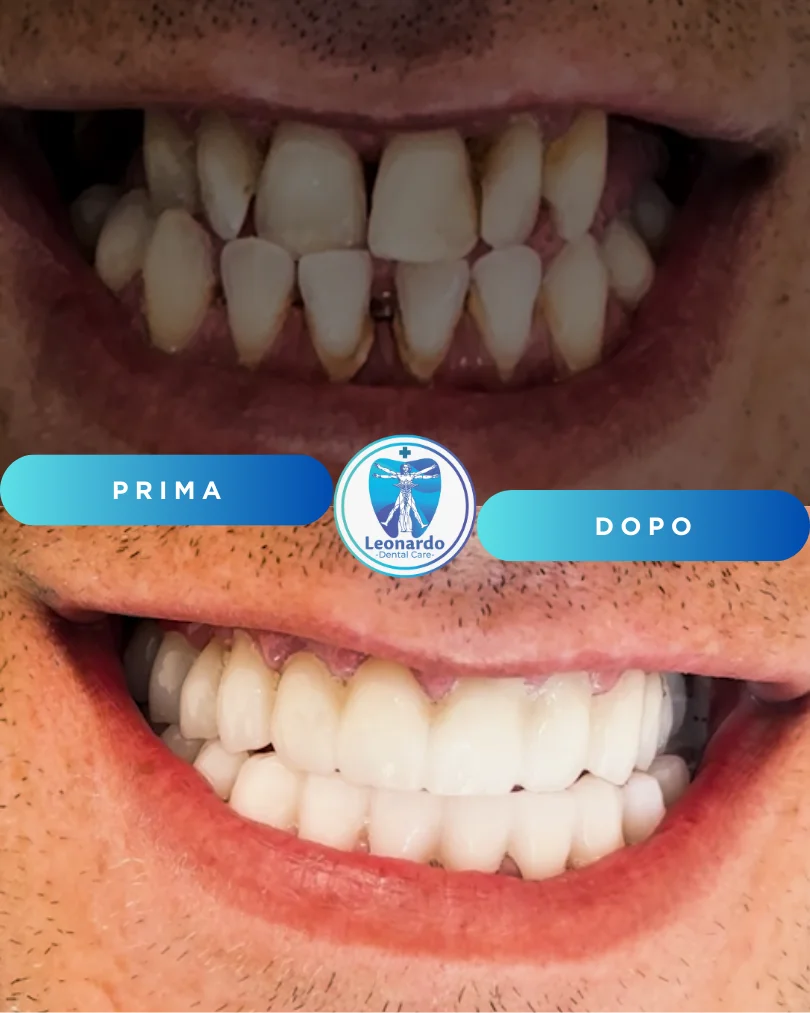 Prima e Dopo 2